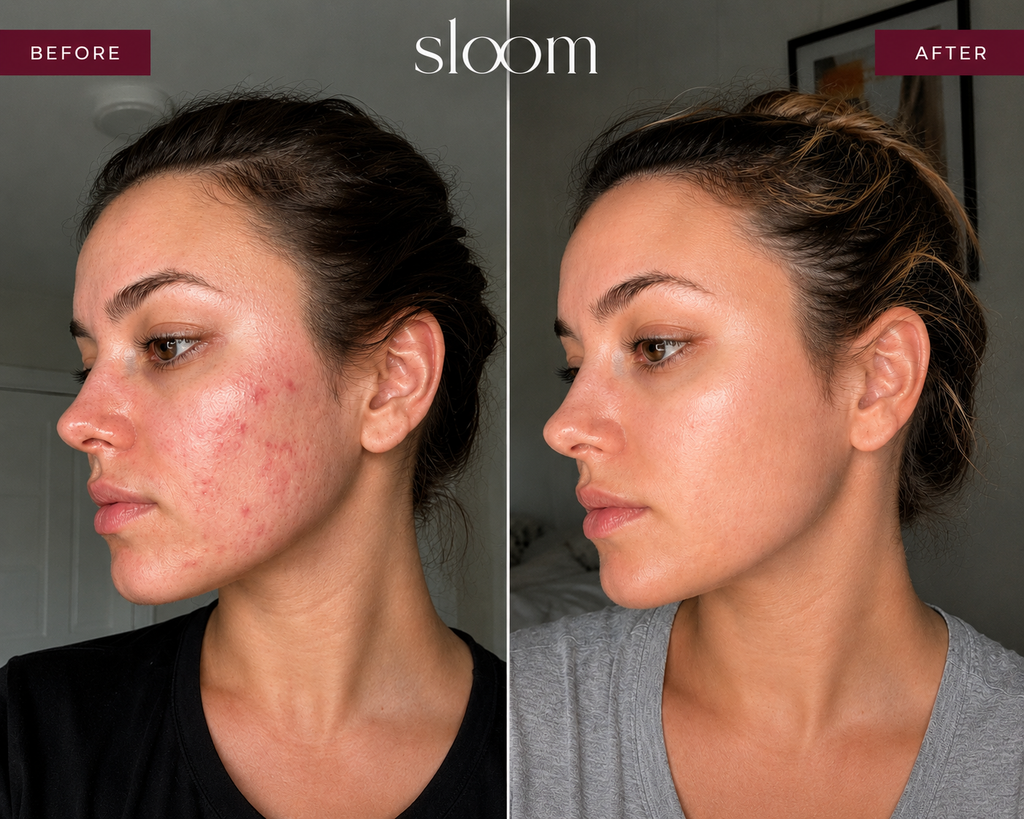 Sloom Frequency Skin Wand